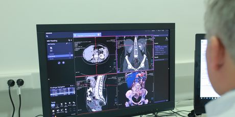 Radiochirurgia Zagreb predstavila novo postignuće (Foto: MKPS)