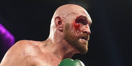 Tyson Fury (Foto: AFP)