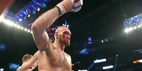 Tyson Fury (Foto: AFP)