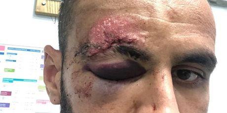 Muzafer Ejupi (Foto: NK Slaven Belupo)