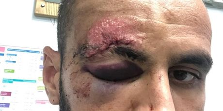 Muzafer Ejupi (Foto: NK Slaven Belupo)