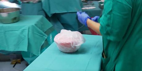 Uspjeh KBC-a Zagreb - 1