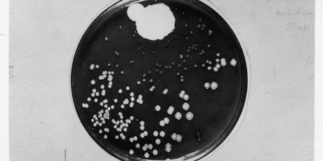 Posudica u kojoj je Fleming proučavao Penicillium notatum