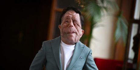 Adam Pearson - 3