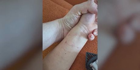 Teta u vrtiću pod optužbama - 1