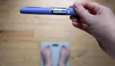 Nakon “Ozempic lica” pojavila su se i “Ozempic stopala” – stručnjaci objašnjavaju što se događa