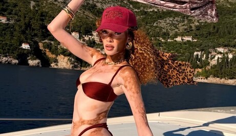 Winnie Harlow - 6