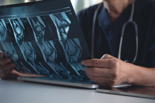 Liječnik proučava rentgensku snimku, ilustracija