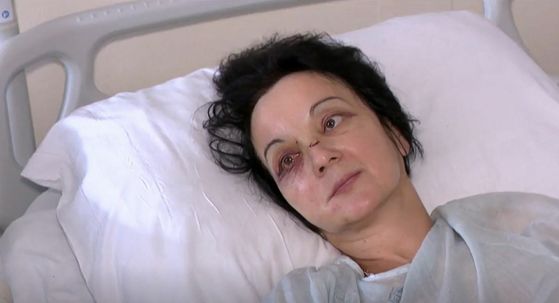 Barbara Szafranska, putnica ozlijeđena u prometnoj nesreći na autocesti - 1