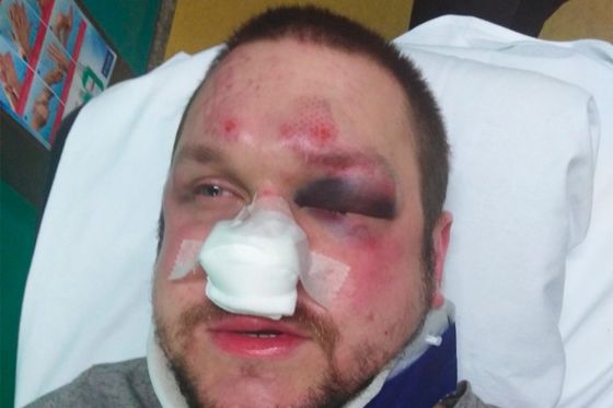 Torcida pretukla slučajnog prolaznika (Dnevnik.hr)