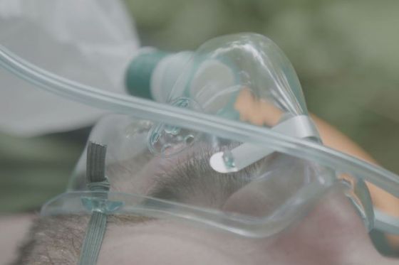 Pacijent na respiratoru