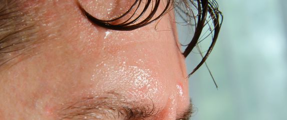 znojno muško čelo i oči