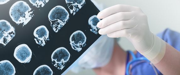 Liječnik pregledava EEG, ilustracija