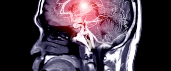 Snimka čovjekova mozga, ilustracija