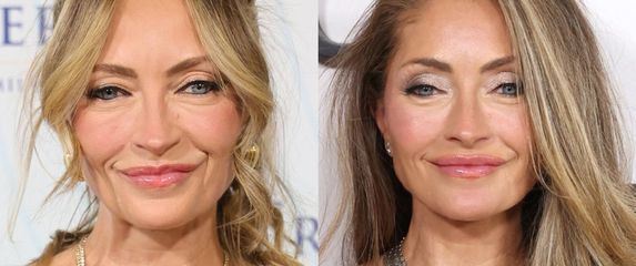 Rebecca Gayheart prije i poslije facelifta (zatezanja lica)