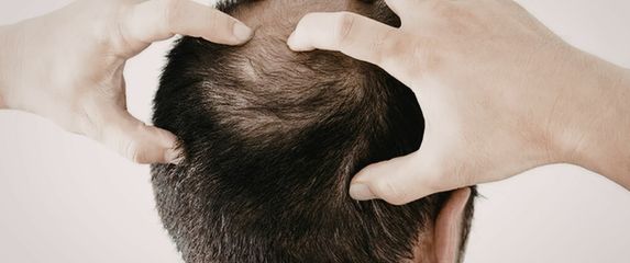 Ćelavi muškarac s rukama na glavi