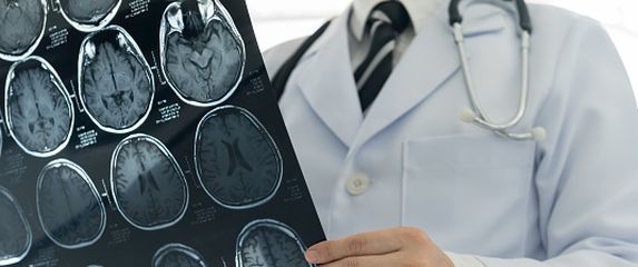 CT glave, ilustracija