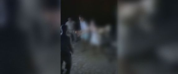 Slovenski turisti pretučeni u sukobu sa zaštitarima u Savudriji - 4