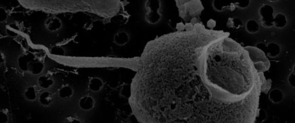 Virus PelV-1 napada plankton