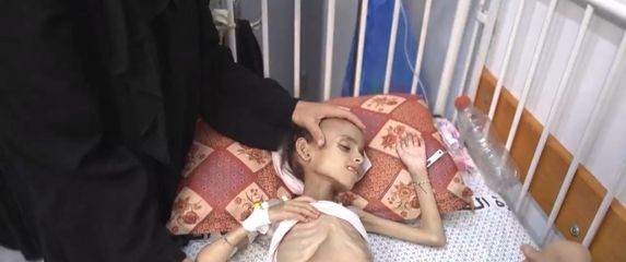 Proglašena glad u Gazi - 5