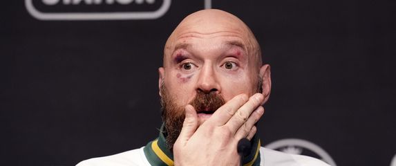 Tyson Fury