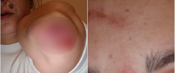 Napadnuta Nives Arnautović