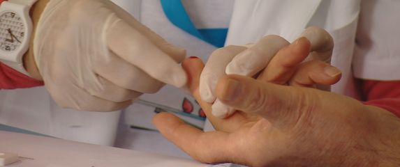 Pregled raka prostate - 3