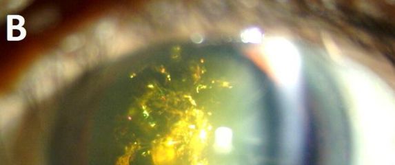 Bolest mrene božićnog drvca