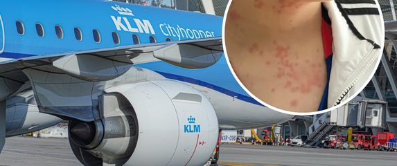 Stjenice u zrakoplovu