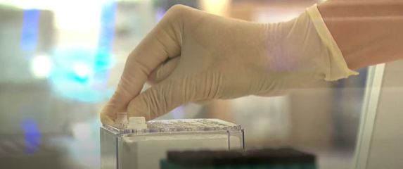 Koronavirus: Stižu novi sojevi, rastu brojke - 5