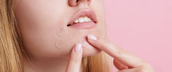 Pimple Patches