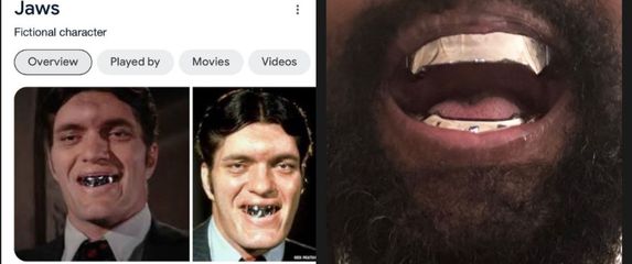 reper kanye west s otvorenim ustima i novom navlakom nalik na lik pored njega imena Jaws iz filmova o jamesu bondu