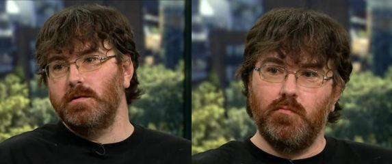 Amerikanac Michael Phillips kako razgovara o svom mikropenisu