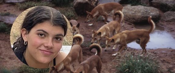 Piper James stradala nakon napada divljih pasa