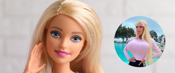 Alicia Amira prije i poslije operacije