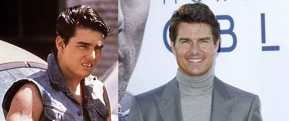 Tom Cruise transformirao je izgled uz pomoću estetske stomatologije