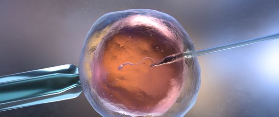 Umjetna oplodnja, IVF, ilustracija