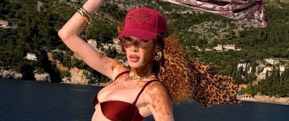 Winnie Harlow - 6