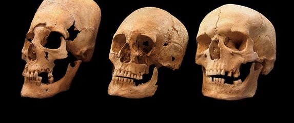 Jako deformirana lubanja (L), lubanja s manjim deformacijama (C) i lubanja bez deformacija (D) - (Foto: State collection for Anthropology and Paleoanatomy Munich)