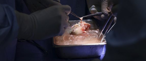 Transplantacija genetski modificiranog bubrega svinje