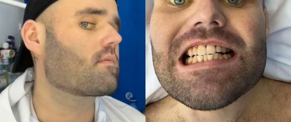 Sean Holland i njegovi simptomi alkoholizma