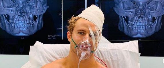 Sage Northcutt nakon operacije lubanje (Foto: Screenshot Instagram)