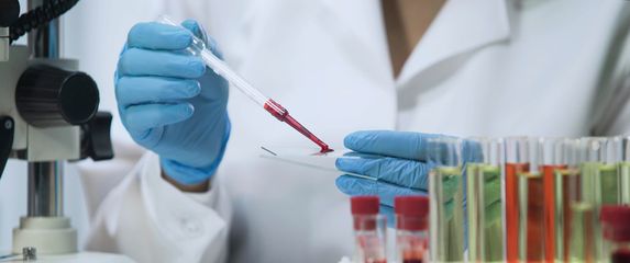 Testiranje krvi u laboratoriju, ilustracija
