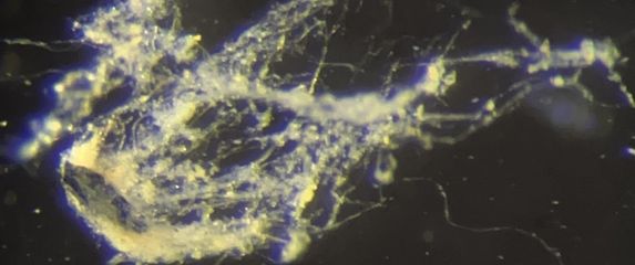 Candidatus Electrothrix yaqonensis