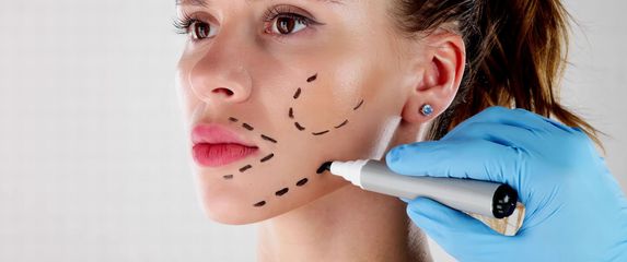 Žena spremna za operaciju lica