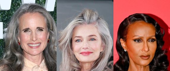 Duga kosa ne poznaje dob