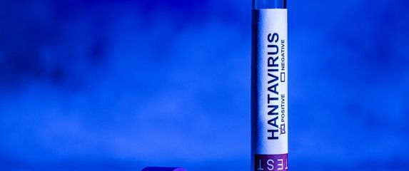 Hantavirus