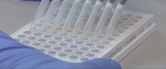 Legionella na zagrebačkom Ekonomskom fakultetu