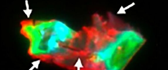 Mikrougrušak u krvi