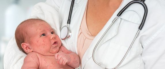 Dijete s ospicama, ilustracija